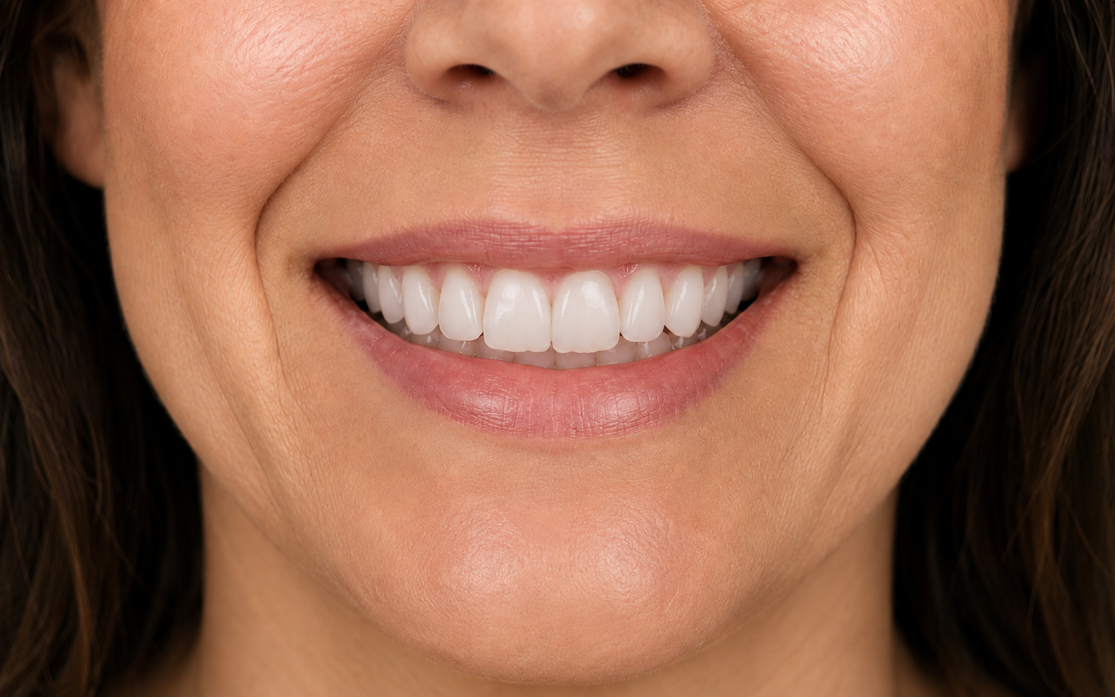 cosmetic-smile-after-reeves-birmingham-al.png