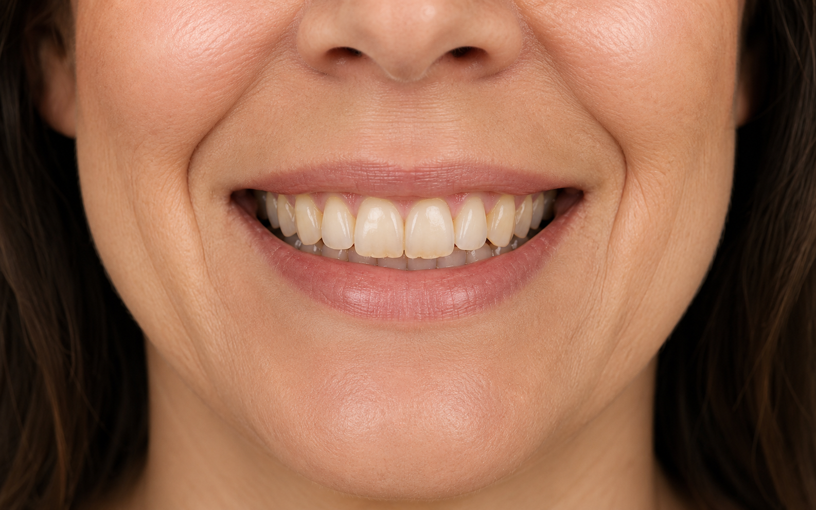 AI-generated placeholder showing a smile before cosmetic dental treatment